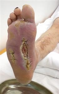 Flexispy Android Review